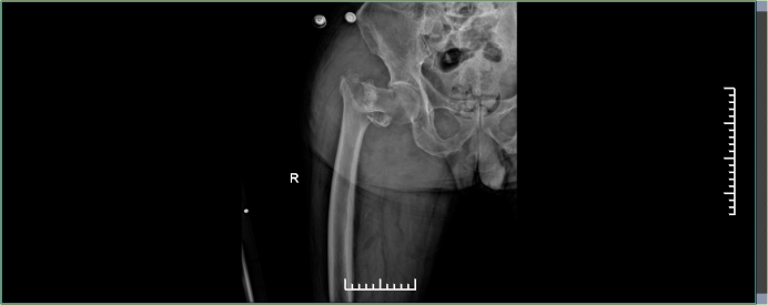 851ead00fc837f0ff9d9c90581610d2