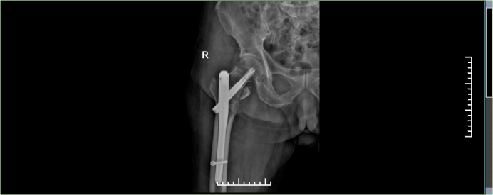 e8b4762b0ab076f2a9a85a76c0853bc