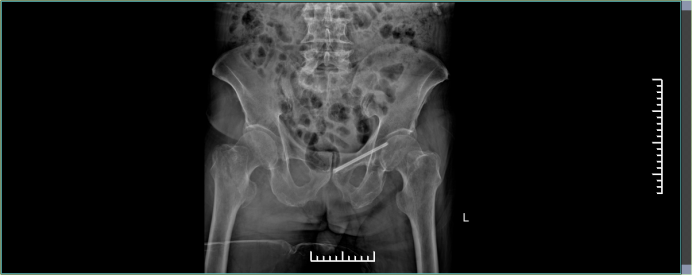 f03147fa935f779ad2f9b7a6523323b