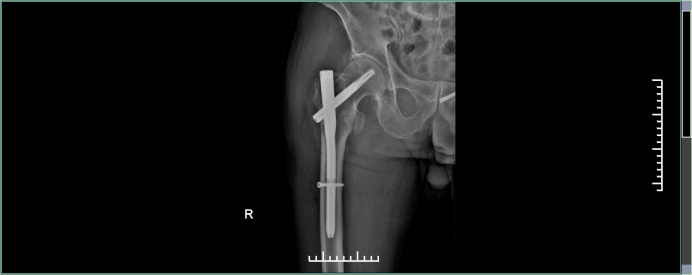 2c12cb683c3bf2a37221a828028026f