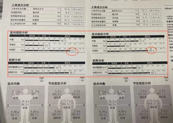 不靠节食就能减肥？萍矿总医院减重门诊：最高30天减重12斤！